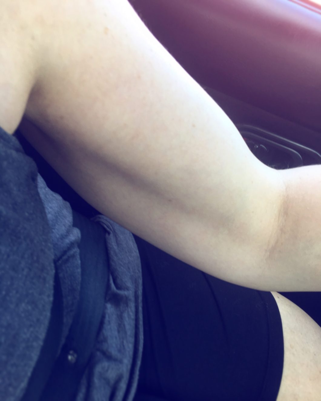 Bonnie Gillespie's Left Bicep