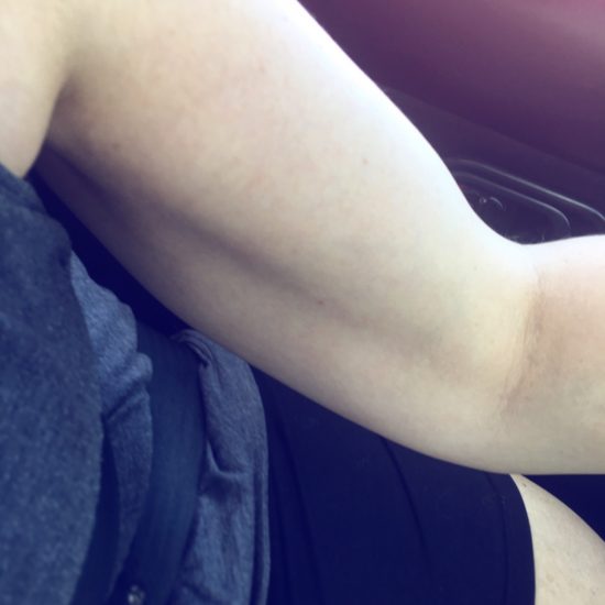 Bonnie Gillespie's Left Bicep